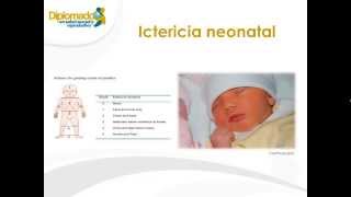 Ictericia neonatal [upl. by Sherill283]