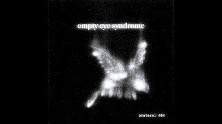 empty eye syndrome slowed [upl. by Shirline]