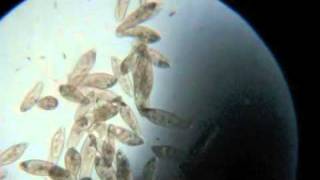 Paramecium Under the Microscope [upl. by Haden]