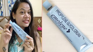 बहुत सारे Moisturiser Use किए कोई अच्छा Moisturiser नहीं मिला Try Emolene Cream [upl. by Nyletac]