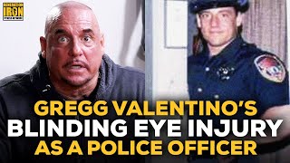 How Gregg Valentino Blinded His Eye During His Time As A Cop [upl. by Clarkin]