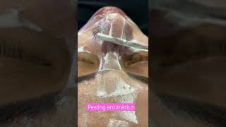 Peeling enzimático com técnica de espatulação [upl. by Irakuy]