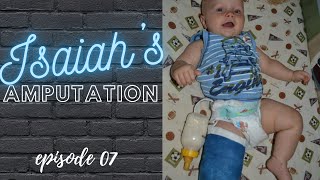 Isaiahs Amputation Story The Climb EP 07 [upl. by Ilecara]