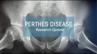 Perthes Disease Research Update  webinar [upl. by Ogu]