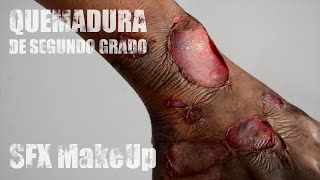 Maquillaje FX Quemadura 2º grado  SFX Second Degree Burn Makeup [upl. by Euhsoj]