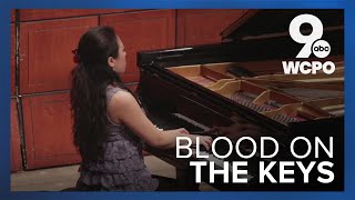 Bloody piano keys Pianist says it doesnt hurt actually [upl. by Everick]