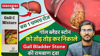 बिना ऑपरेशन पित्त की थैली में पथरी का इलाज  How to Dissolve Gallbladder Stone  GallC Mixture [upl. by Enahpad]