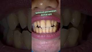 Dental Spa di Klinik Parakita yuk Cabang Talasapang atau Cabang Perintis ya [upl. by Divadnoj332]