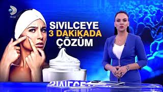 Sivilceye karşı 3 dakikada kesin cözüm [upl. by Nika]