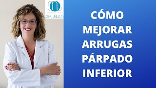 quotBlefaroticsquot movimientos involuntarios del párpado [upl. by Eerdna]