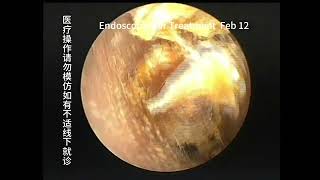 Differences in 3 types of ear conditions [upl. by Talbott]