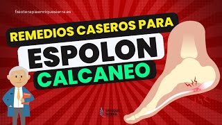 REMEDIOS CASEROS PARA ESPOLÓN CALCÁNEO 👣 [upl. by Hubert]