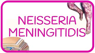 NEISSERIA MENINGITIDIS  meningococemia Sx de Waterhouse Friderichsen CID meningitis síntomas [upl. by Ahsoyek]