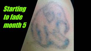 thINK Tattoo Removal Cream 2018 [upl. by Perice577]