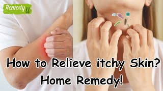 FAST Relief from Itchy Skin with These SHOCKING Remedies [upl. by Adnohrahs]