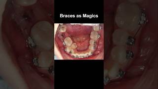 Braces as magics fix all problem braces orthodontist dentist dentistry [upl. by Stanly]