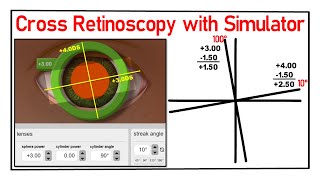 Cross Retinoscopy with Simulator How practice with Simulator [upl. by Erasaec928]