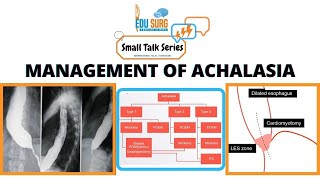 Achalasia cardia management [upl. by Aiym]