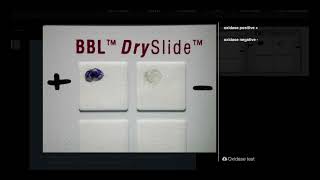 Oxidase Test DrySlide  Microbiology [upl. by Zerep83]