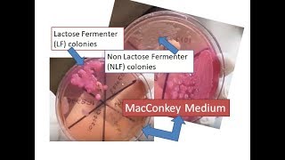 MacConkey medium showing lactose and non lactose fermenter colonies [upl. by Edris441]