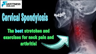 Best exercises for cervical spondylosis  spondylitis neck exercises [upl. by Nylyram202]