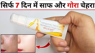 Melacare Cream Review in Hindi मेलाकेयर क्रीम के फायदे नुकसान उपयोग [upl. by Lamrert]