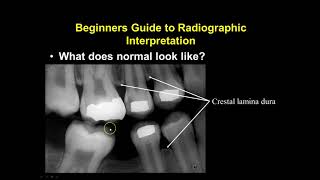 Radiographic Interpretation Section 1 [upl. by Ibocaj]