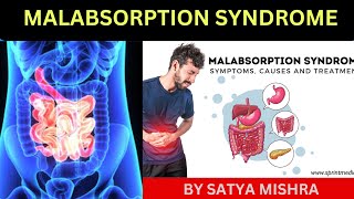 Malabsorption Syndrome  child health Nursing Online Nursing Classes  Easy Explanation in Hindi [upl. by Scornik]