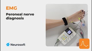 EMG the peroneal nerve diagnosis [upl. by Selec]