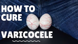 How to cure Varicocele without Surgery [upl. by Htebazileyram]