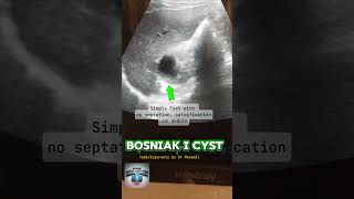 BOSNIAK I Cyst fy radiological fypyoutube radiologist science [upl. by Peony]