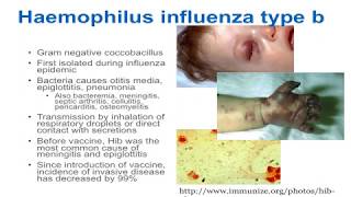 Poliomyelitis  Symptoms and Prevention [upl. by Htidra]