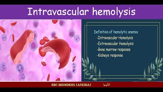 Lecture 212 Intravascular hemolysis [upl. by Nylarak]