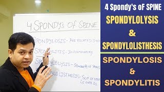 Spondylosis Spondylolisthesis Spondylitis Spondylolysis Cervical and Lumbar spondylosis [upl. by Nonnah]